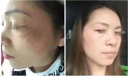 高潮脸合集吃瓜网,吃瓜网带你揭秘娱乐圈的“表情包”风云